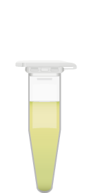urine-sample-uti-test